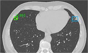 CT Scan Demo